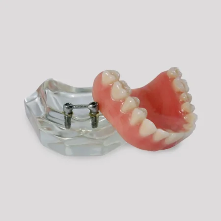 4215 A - MAXILA ACRILICA BARRA CLIP