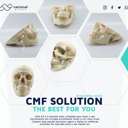 12957 - KIT CMF SOLUTION