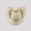manequim-ortogn_tico-assim_trico-classe-2-e-3-para-treinamento-de-cirurgia-ortogn_tica-odontologia-fabricado-por-nacional-ossos-sinteticos-artificiais-03_1